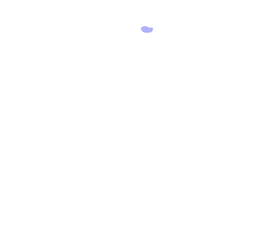 Supraorbital Foramen