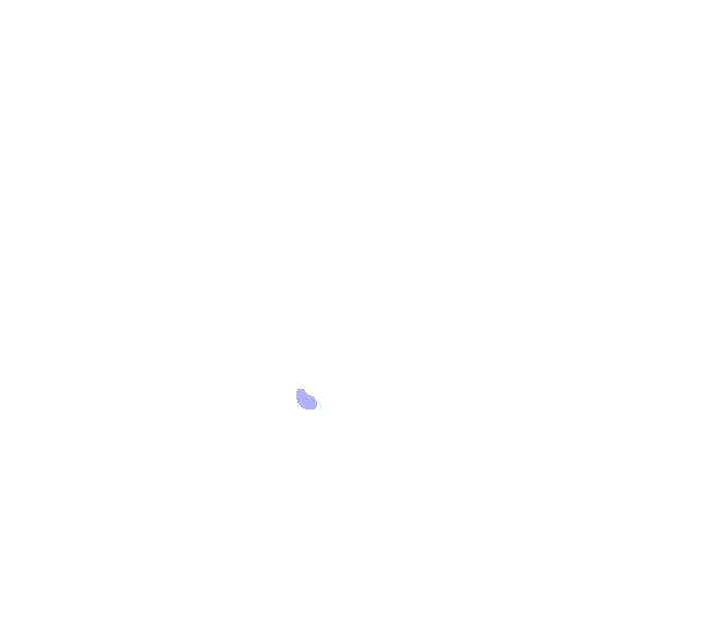 External Auditory Meatus