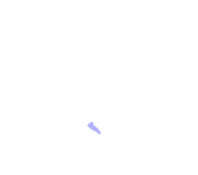 Styloid Process