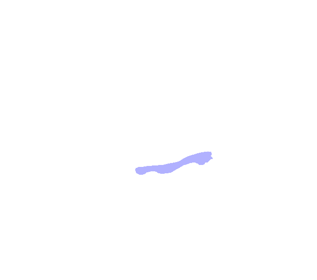 Zygomatic Process