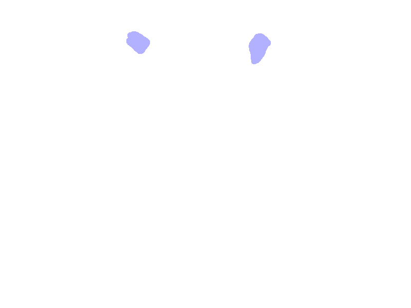 Ethmoid