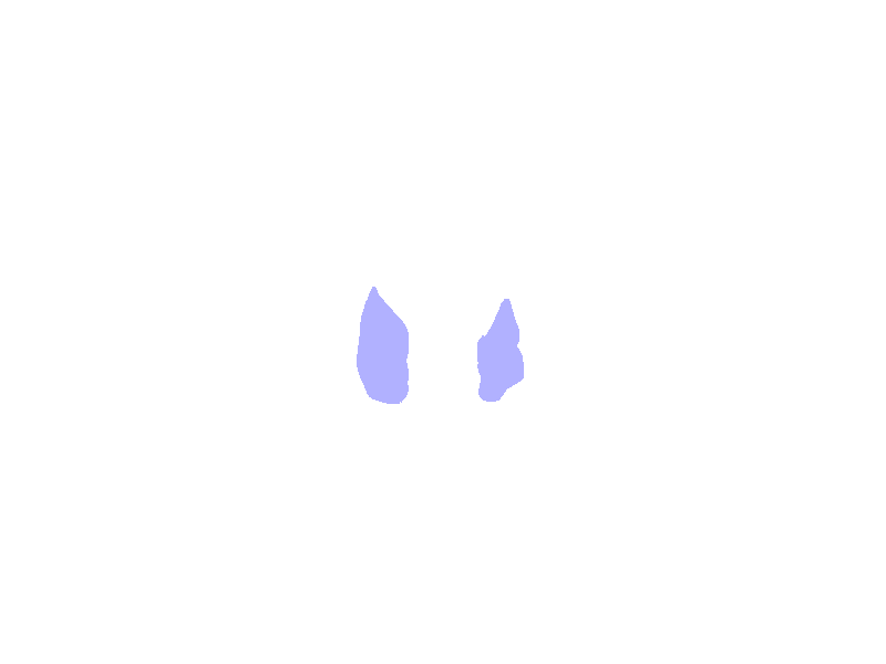 Inferior Nasal Conchae