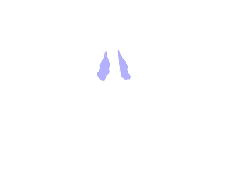 Middle Nasal Conchae
