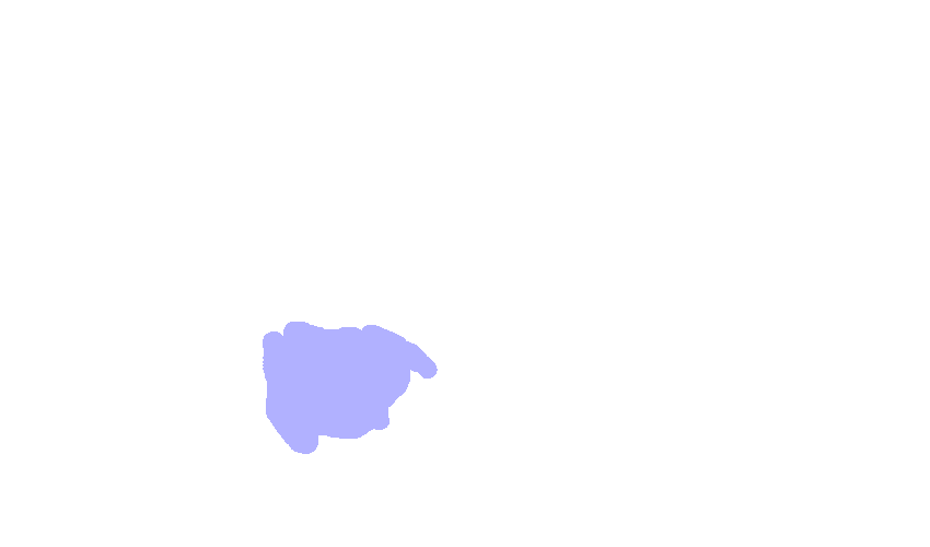 Foramen Lacerum