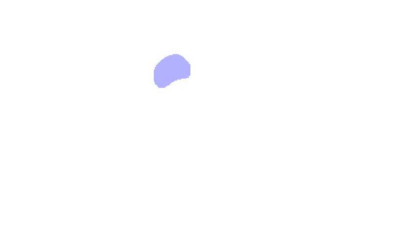 Foramen Rotundum