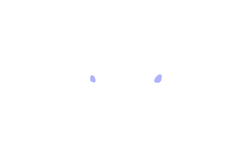 Foramen Rotundum