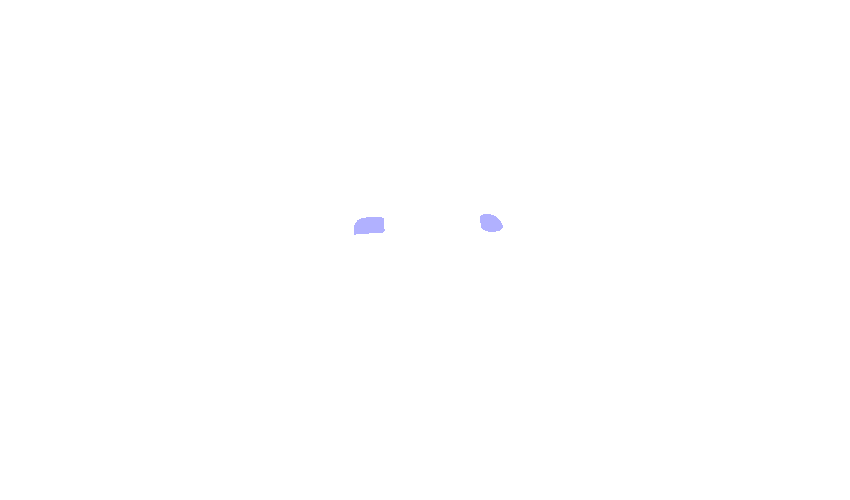 Optic Foramen