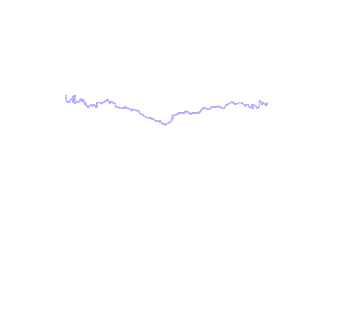 Coronal Suture