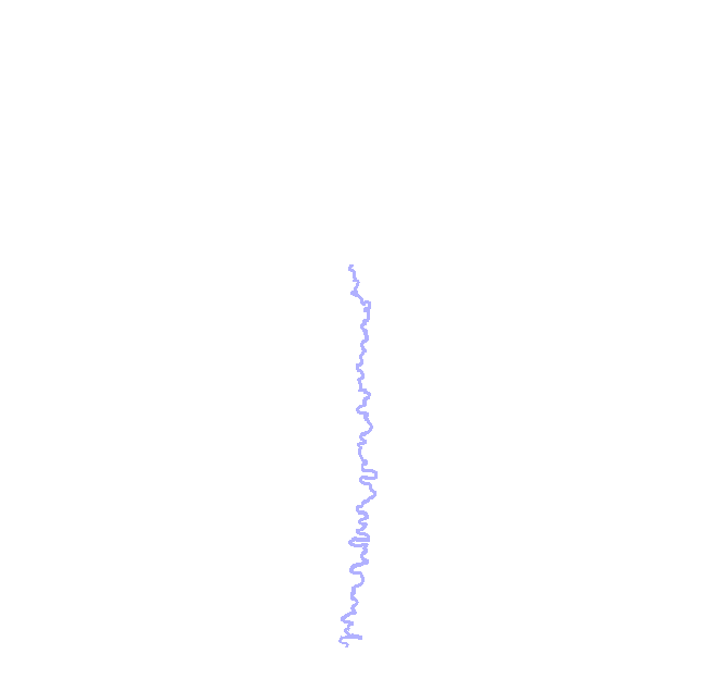 Sagittal Suture