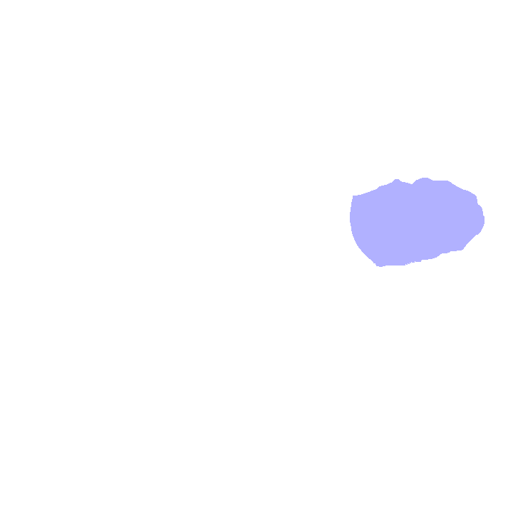 Transverse Processes