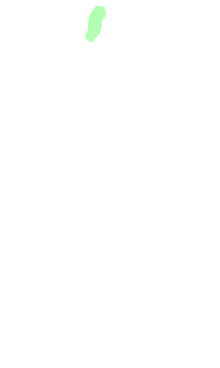 Olfactory Bulb