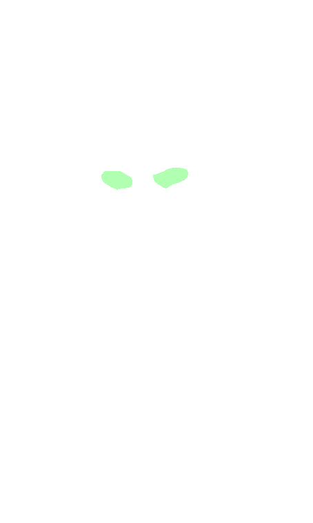 Optic