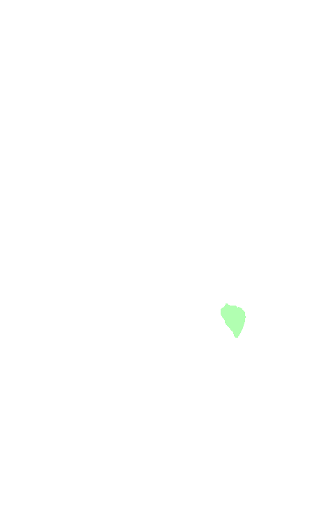 Trigeminal