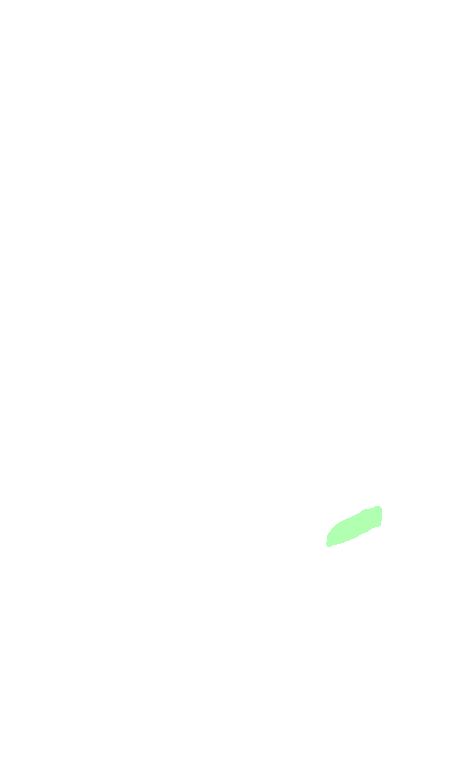 Vestibulocochlear