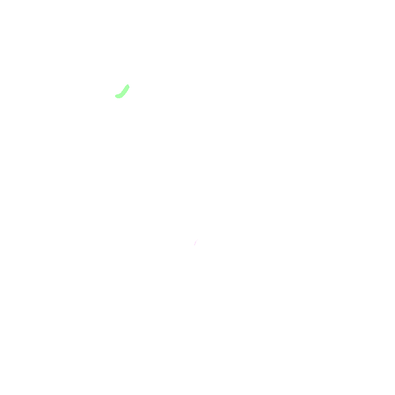 Vertebral Notch