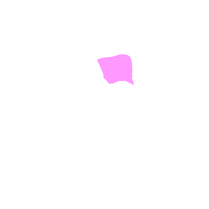 Vertebral Foramen (Canal)