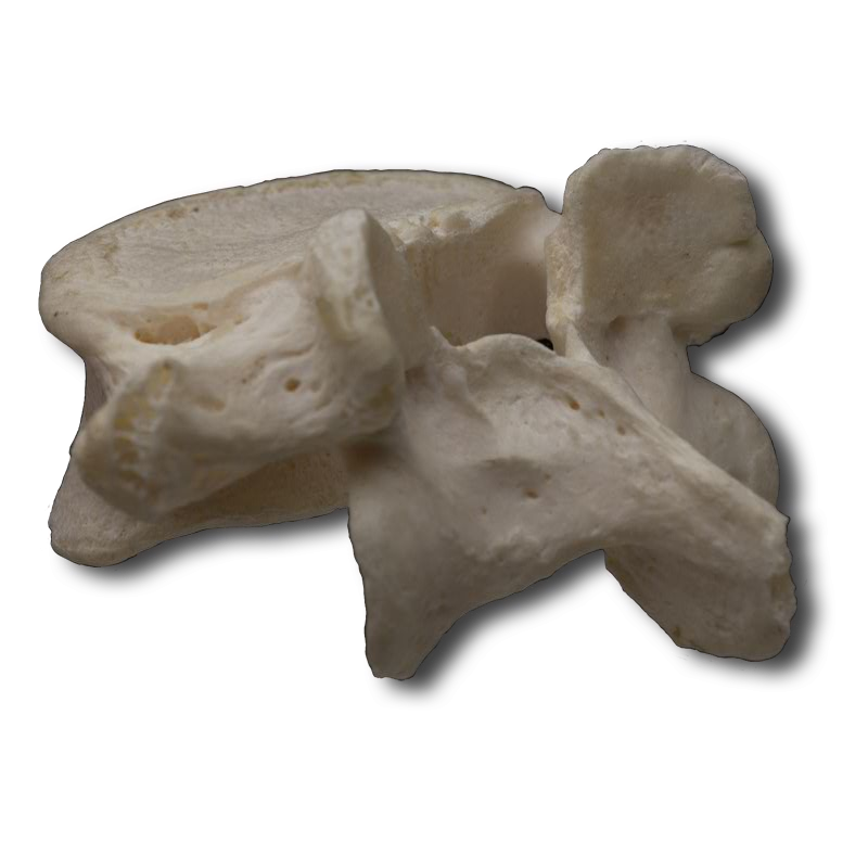 Postero-Lateral Lumbar Vertebrae