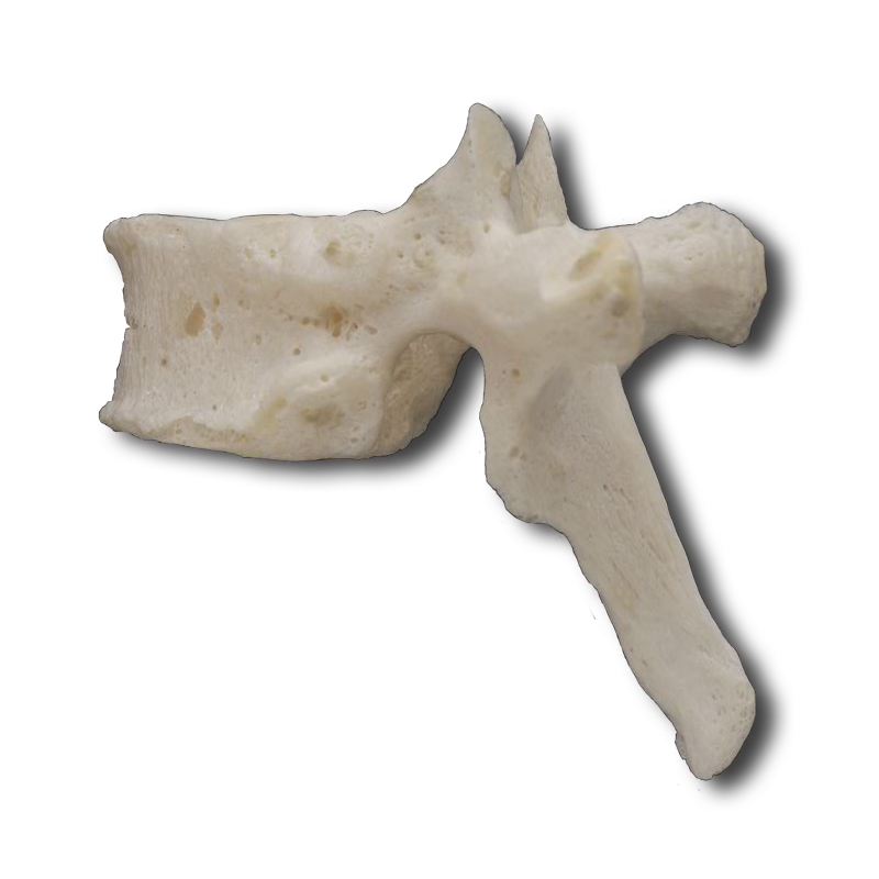 Lateral Thoracic Vertebrae