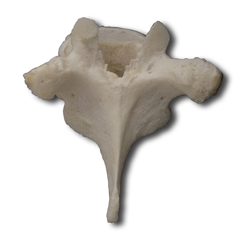 Posterior Thoracic Vertebrae