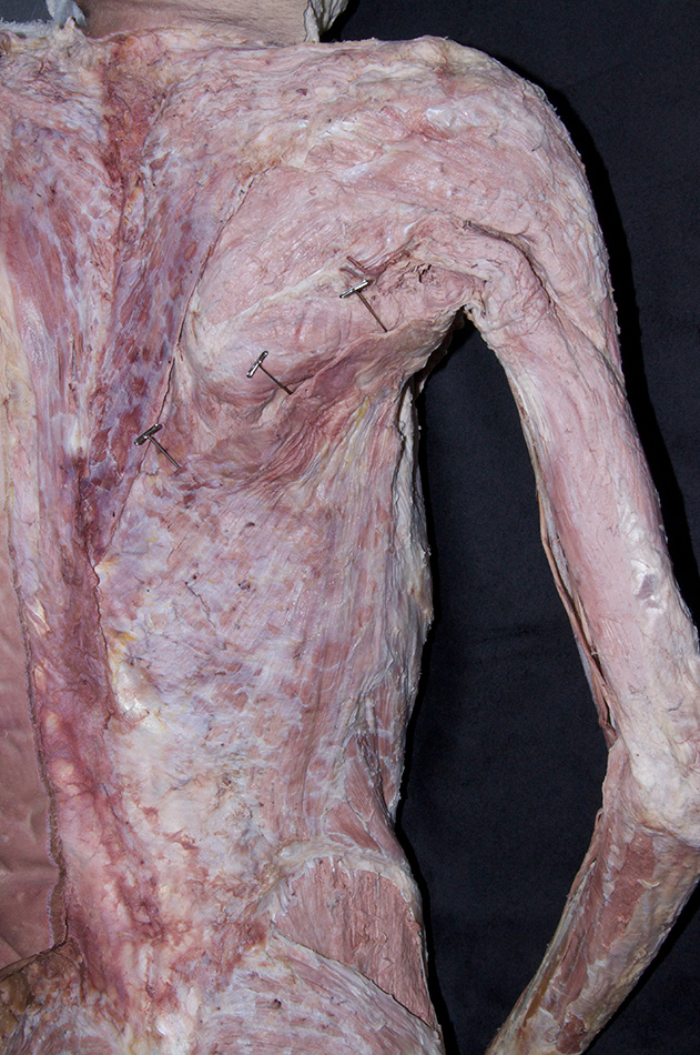 Latissimus Dorsi Muscle