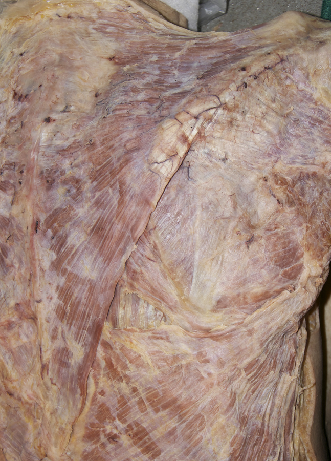 Trapezius Muscle