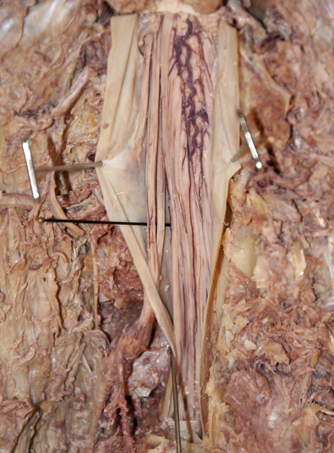 Dorsal and Ventral Roots