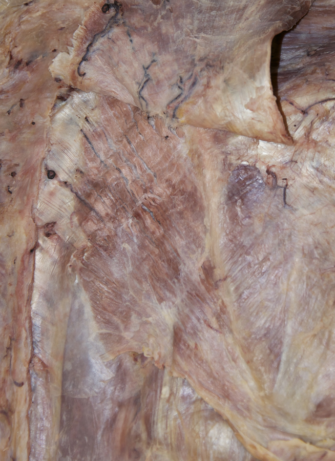 Rhomboid Muscles