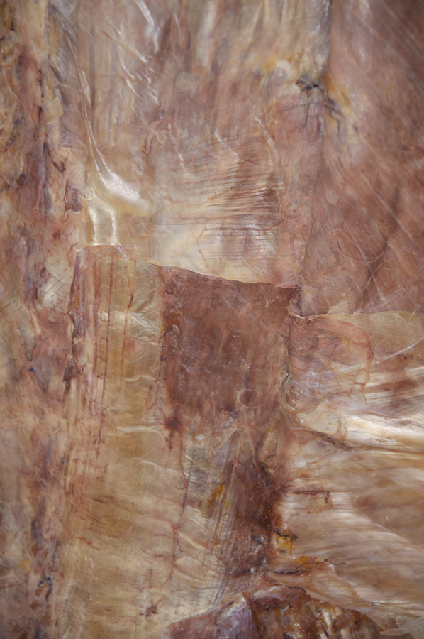 Thoracolumbar Fascia