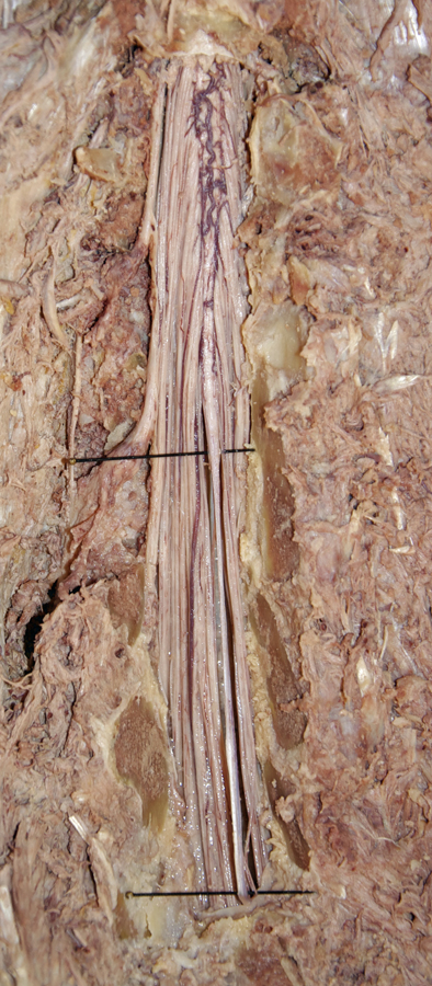 Spinal Cord