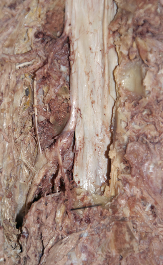 Dura Mater