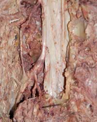 Spinal Nerve