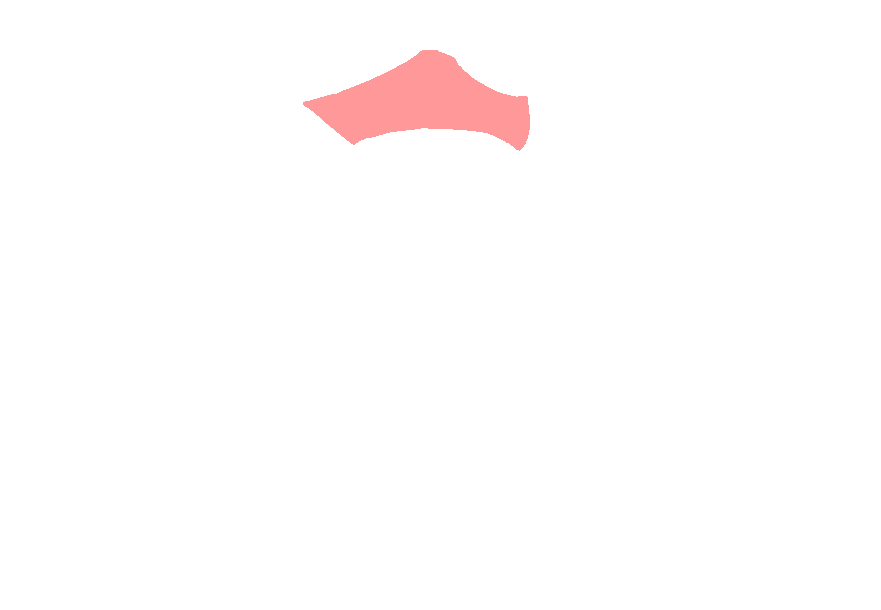 Atlas superior anterior arch