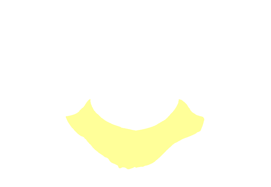 Atlas superior posterior arch