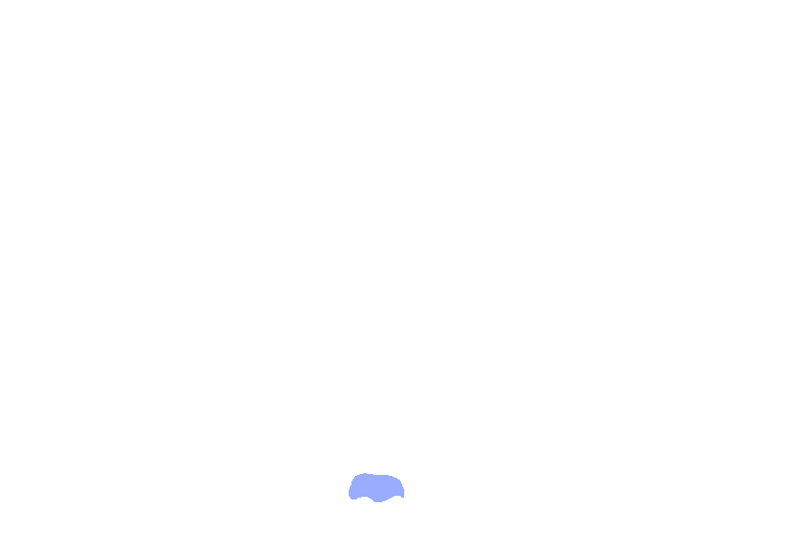 Atlas superior posterior tubercle