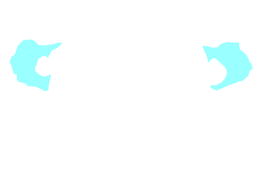 Atlas superior transverse process