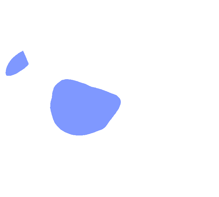Axis anterior superior articular facet
