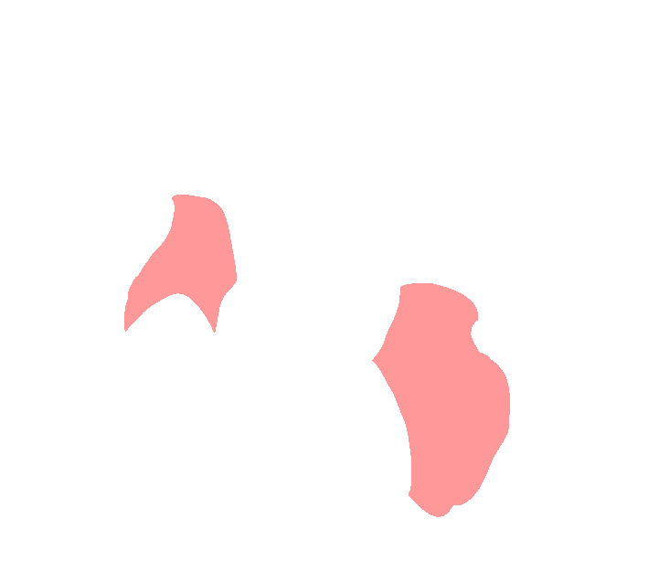 Axis posterior pedicle