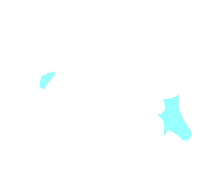 Axis posterior transverse process