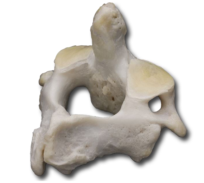 Axis posterior.png