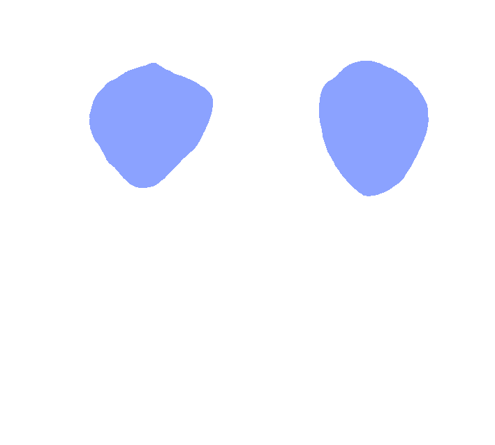 Axis superior superior articular facet