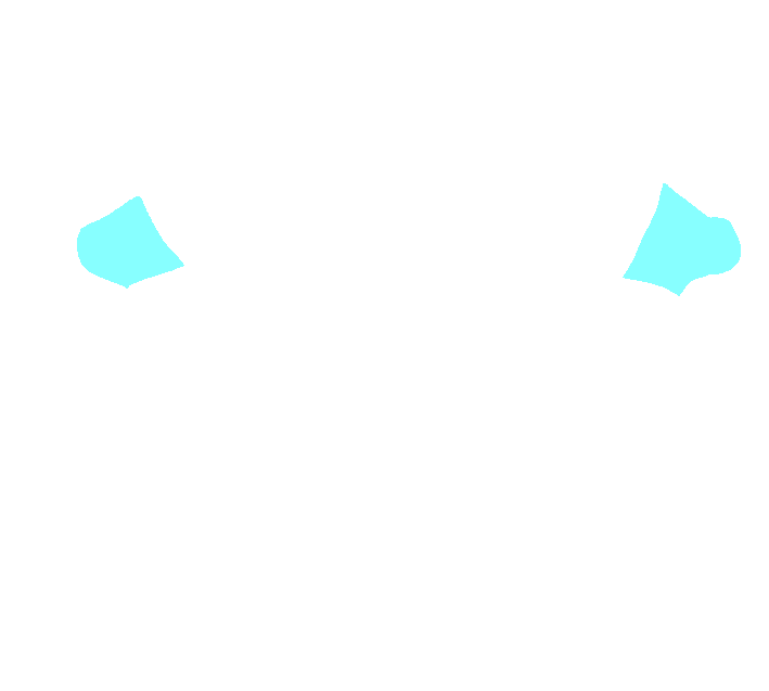 Axis superior transverse process