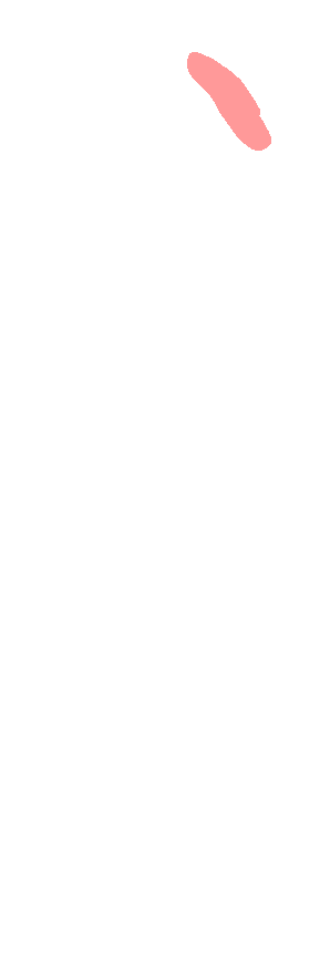 Acromial end