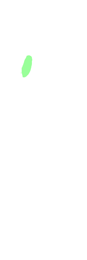 Conoid tubercle