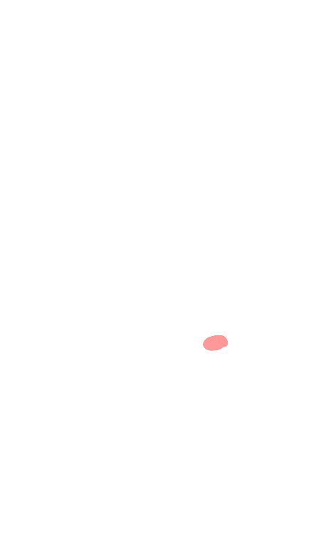 Anterior commissure