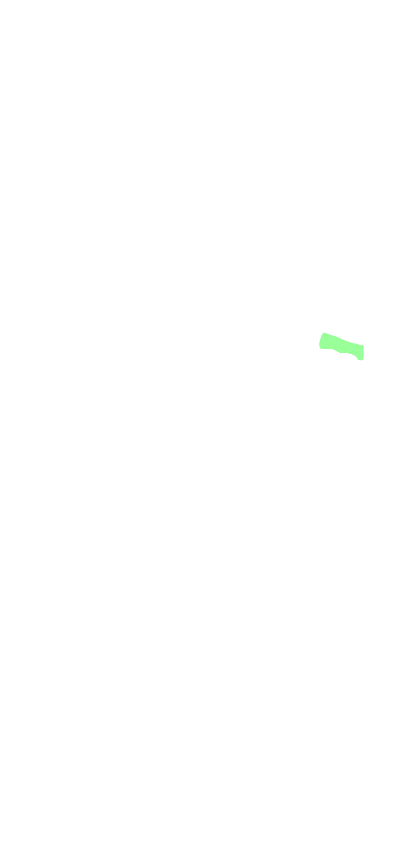 Anterior commissure