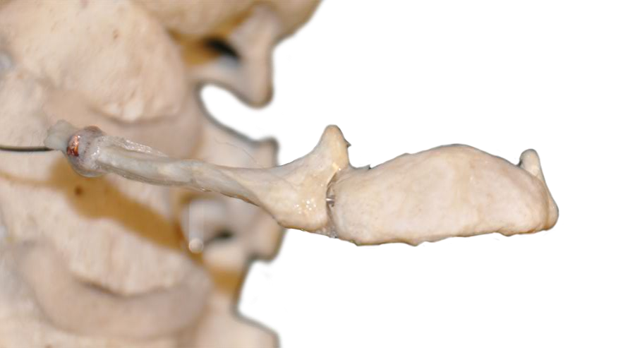 Hyoid Bone