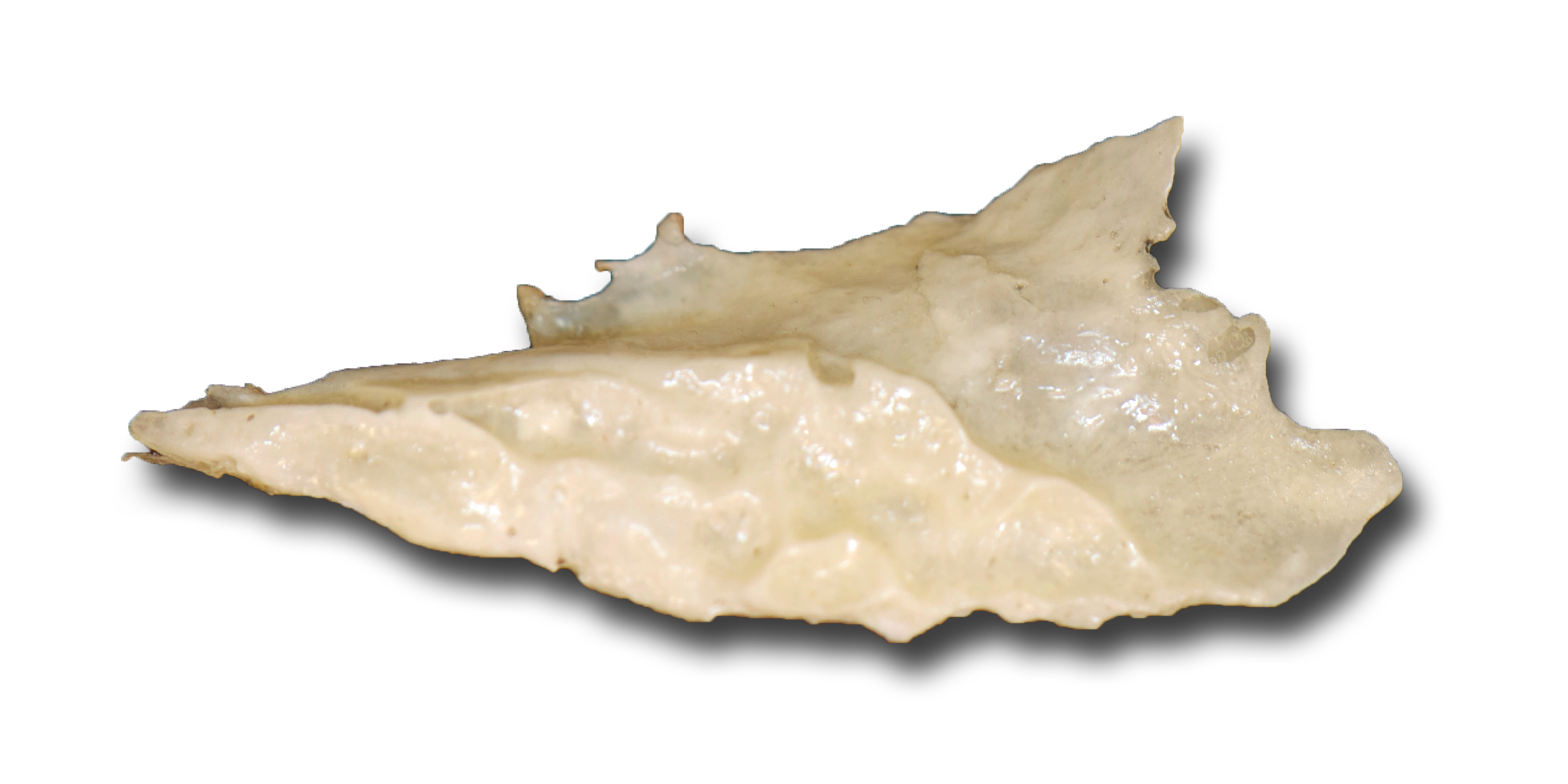 Inferior concha medial