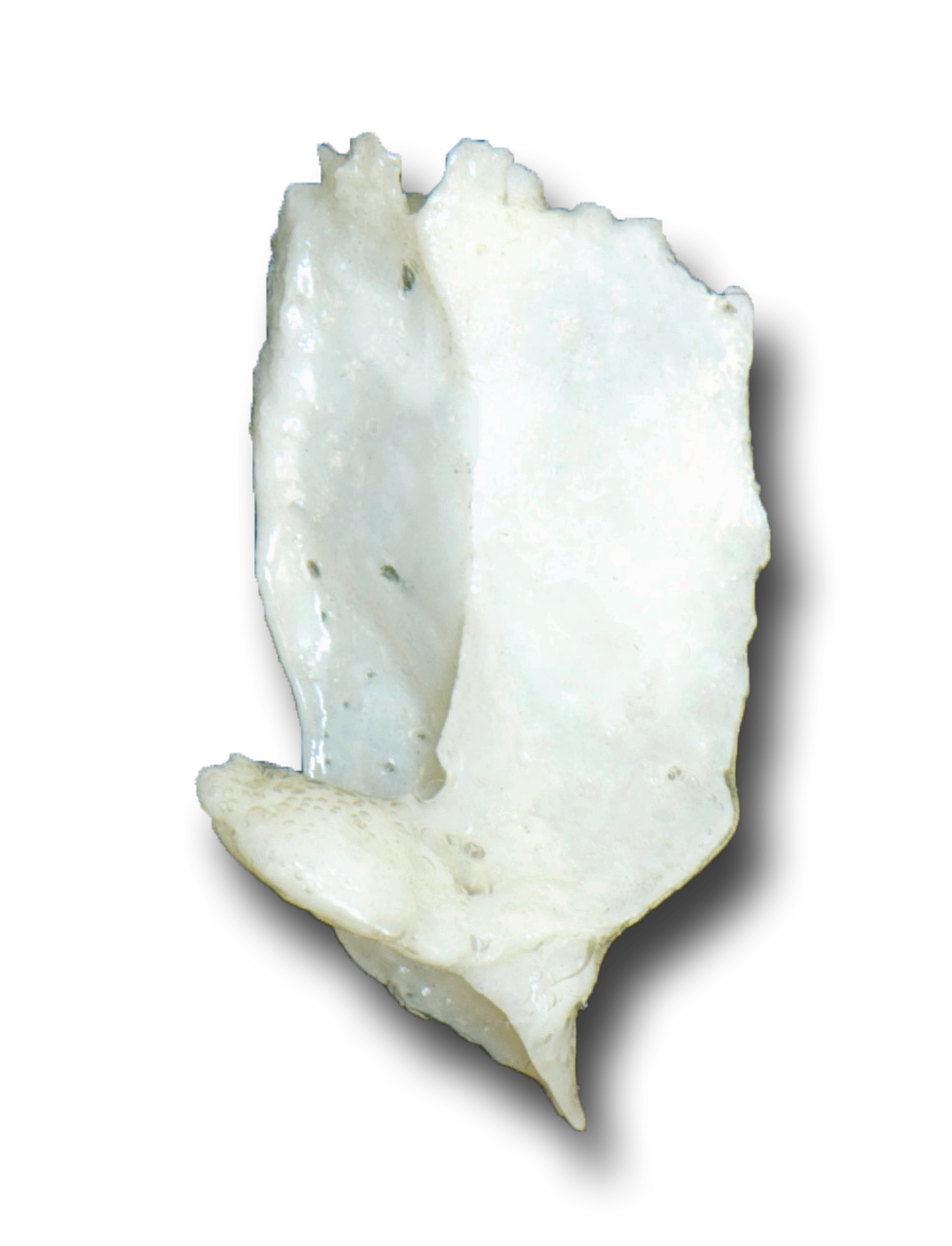 Lacrimal lateral