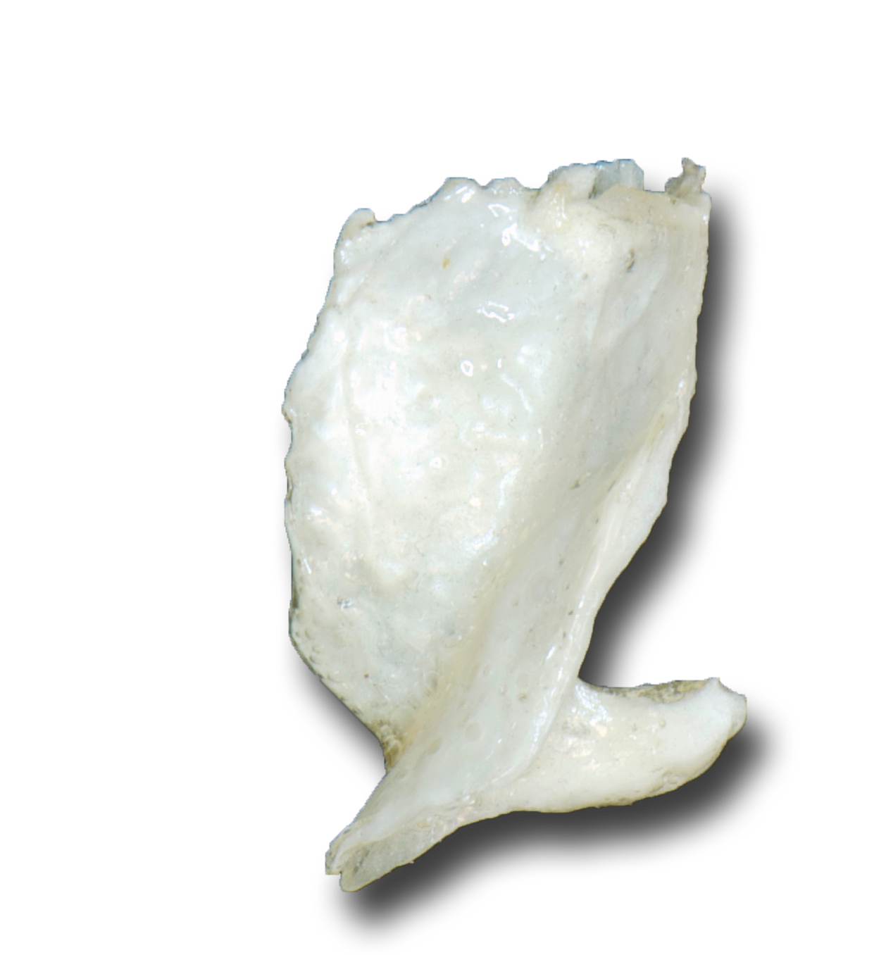 Lacrimal medial
