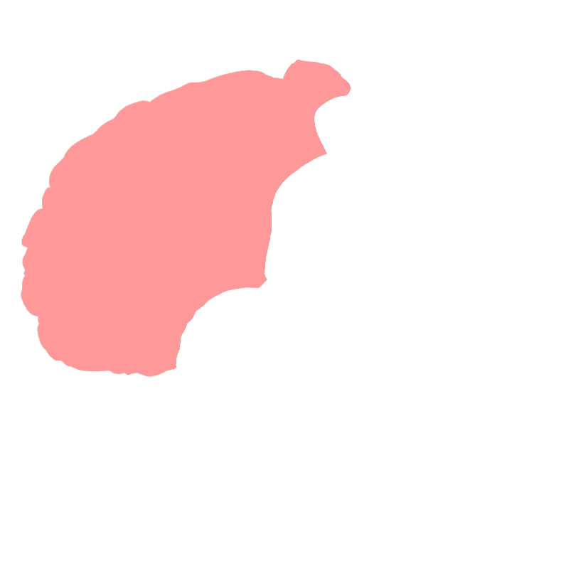 Frontal lobe
